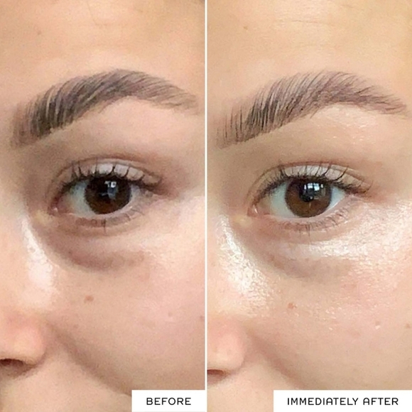 REN CLEAN SKINCARE Radiance Brightening Dark Circle Eye Cream 15 mL / 0.5 OZ - Picture 9 of 13